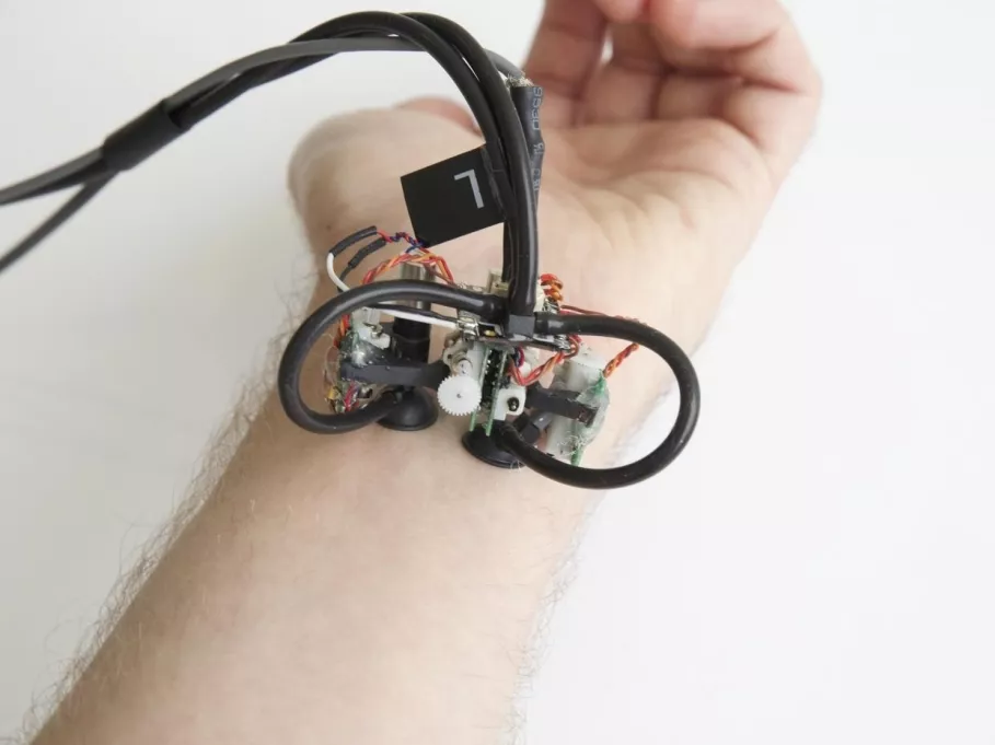 Bőrünkön mászó robot helyettesítheti az orvosokat a jövőben